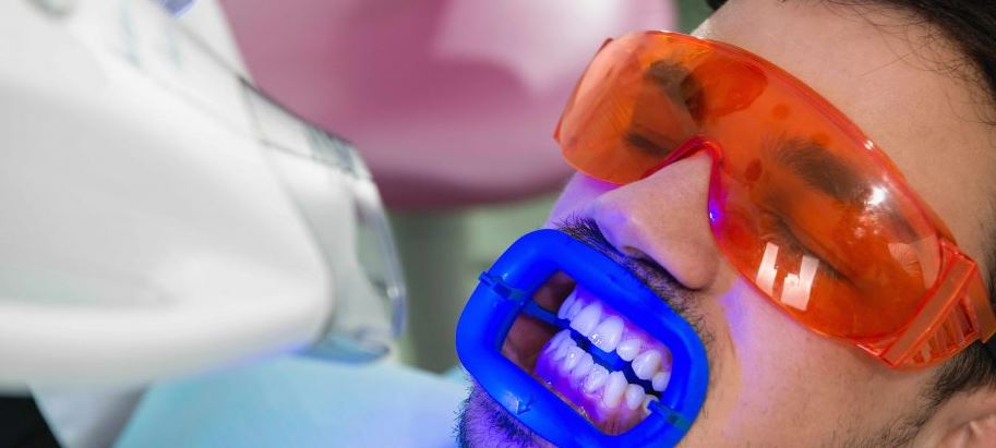 teeth whitening